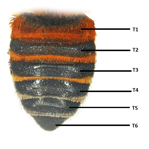 Metasoma